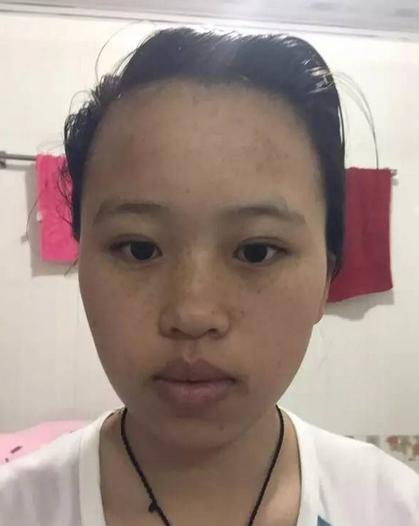 2017韩国中发蛋卷头,韩版小清新lob头