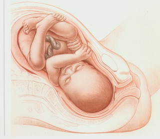 盆骨怎么看女的生过孩子没,骨盆怎么看是否倾斜