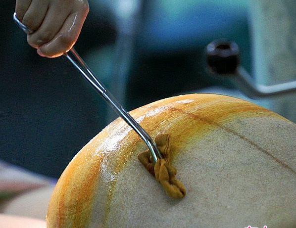 经历了剖腹产才知道妈妈的不容易,看了剖腹产才明白妈妈是多么伟大