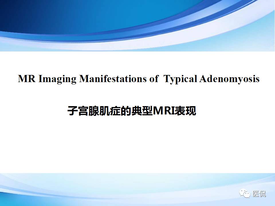 双语PPT：子宫腺肌症常见和不常见的MRI表现医学影像