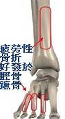 早晨跑步还是晚上跑步对身体好,早上跑步还是晚上跑步对身体好