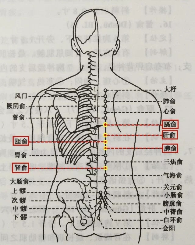 期门穴拔罐治胆囊炎吗,胆囊炎拔罐针灸管用吗