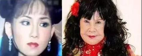 香港最老明星整容失败照片对比,整容失败的明星有哪些