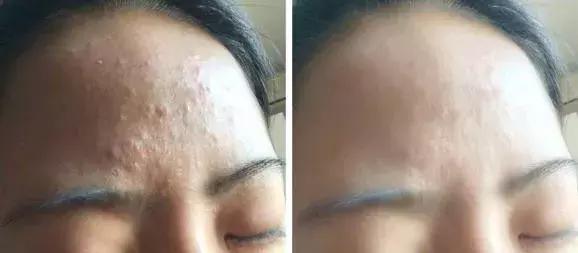 敏感肌卸妆洁面乳,适合敏感肌用的去角质洁面乳