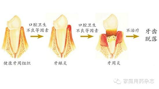 吃货一定要保护好牙齿,爱护牙齿才能吃更多的美食
