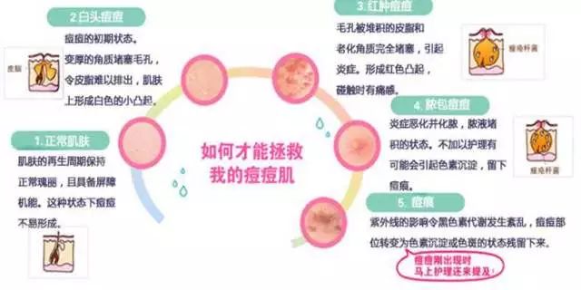 雪花秀宫中蜜皂正品,雪花秀宫中蜜皂是氨基酸吗