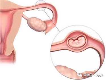 孕早期出血的几种原因你知道几个,孕初期出血的原因都有哪些