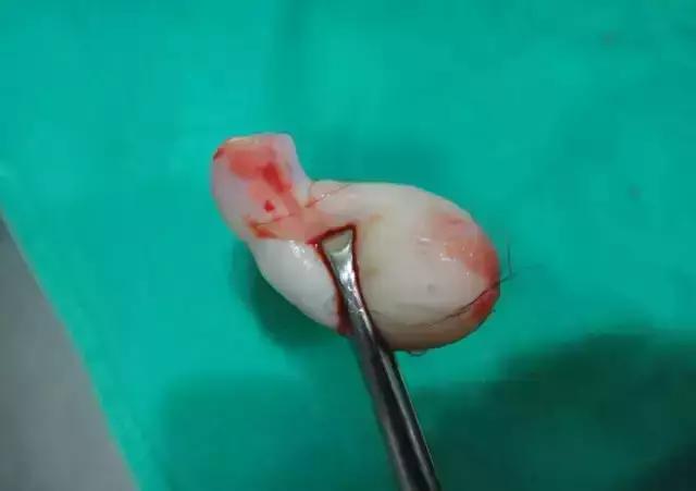 26岁孕妇二胎顺产第十天，莫名掉出“一块肉”医生检查后怒骂无知