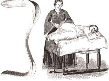 11位*奴女**5年遭受近50次痛苦手术，却成就了他“妇科之父”的荣耀