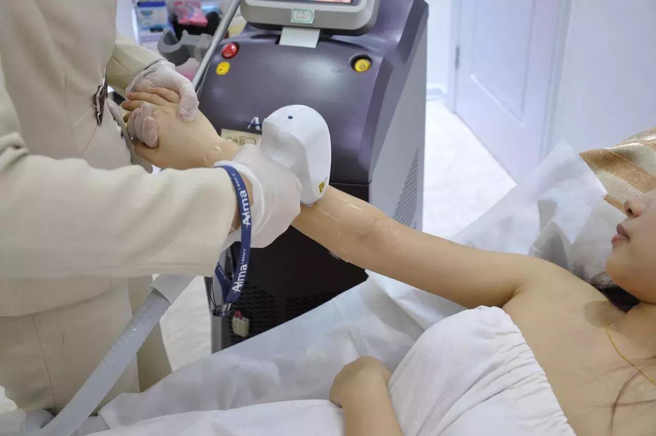 永久脱毛19.9元团购,全身终身脱毛优惠团购广州