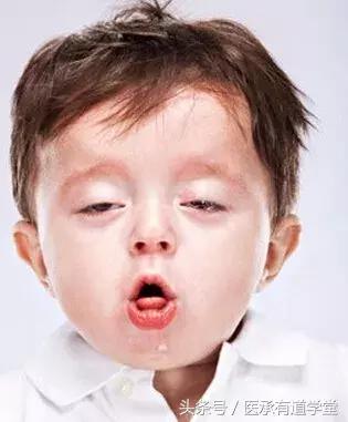 黄甡发育迟缓,黄甡怎么样