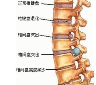 一说话就腰痛是什么原因,站着腰痛是什么原因