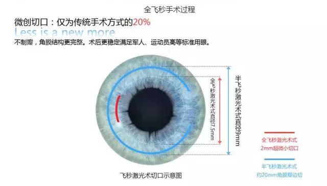 矫正视力超过600度到底能不能参军,近视眼做不了飞秒还能当兵吗