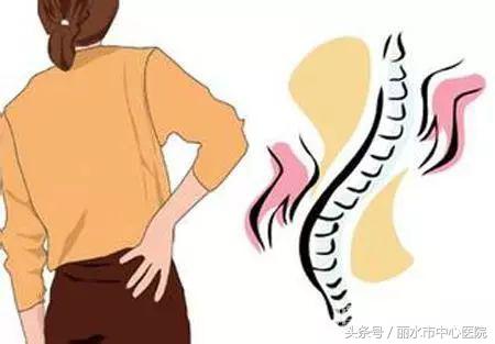 脊柱软组织损伤怎么治疗,医生谈脊柱侧弯矫正