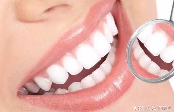 戴牙套可以洗牙吗有必要洗牙吗,矫正牙齿戴牙套期间可以洗牙吗