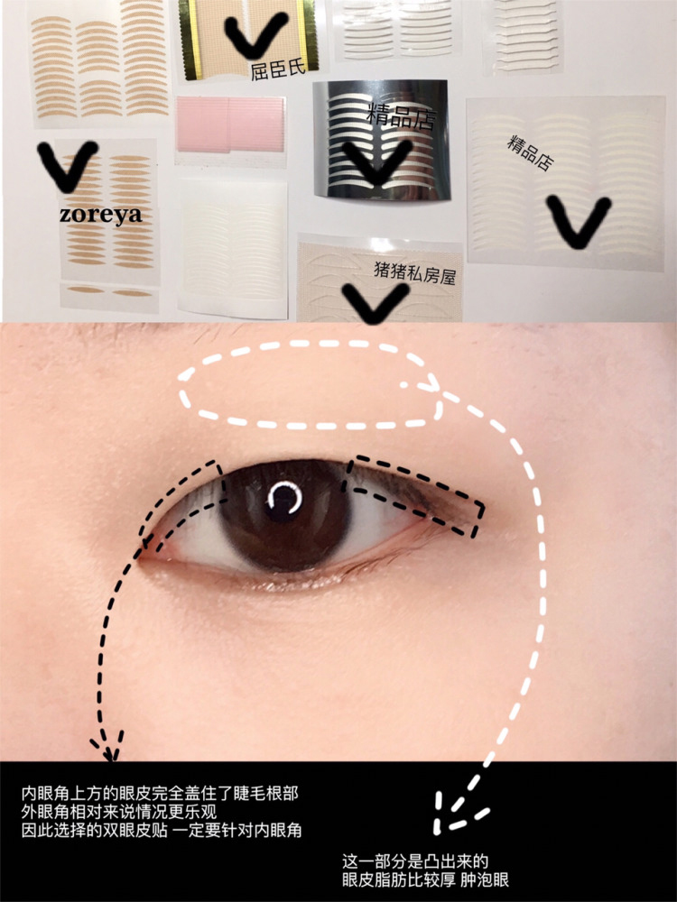 内双贴双眼皮贴可以变外双吗,内双肿眼泡怎么贴双眼皮新手教程