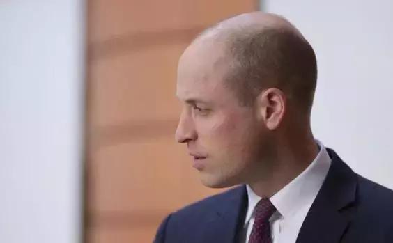 37岁威廉王子秃头,威廉王子剃掉光头