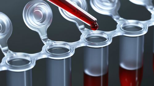 肿瘤标志物升高但是影像报告稳定,化疗后肿瘤标志物升高意味着什么