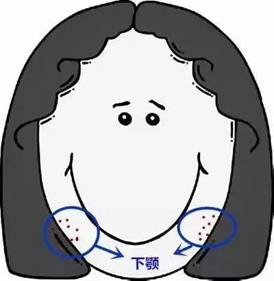 郑爽屏幕前貌美如花，幕后满脸痘花，明星都被坑的痘痘该怎么治？