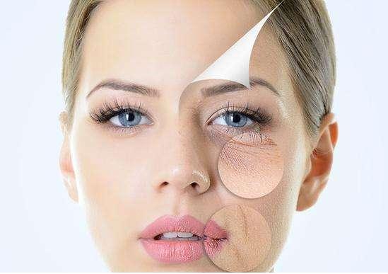 嘴角纹有什么办法去除,嘴角纹怎么消除吃什么食物好