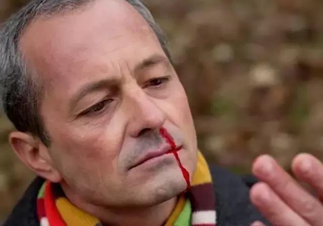 肿瘤标志物有几项,肿瘤红色