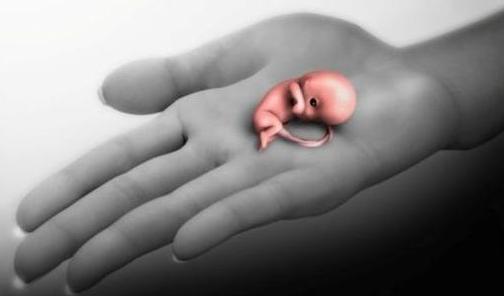 孕初期梦到自己流产了怎么办,孕妈故意流产