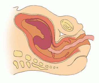 孕妇大肚子在水中分娩过程,中国孕妇在水中分娩过程
