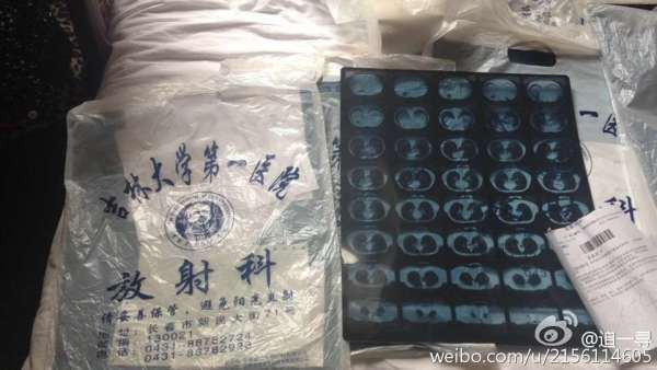 毒情严重的学校需要配备什么,毒教材事件给小孩会带来什么结果