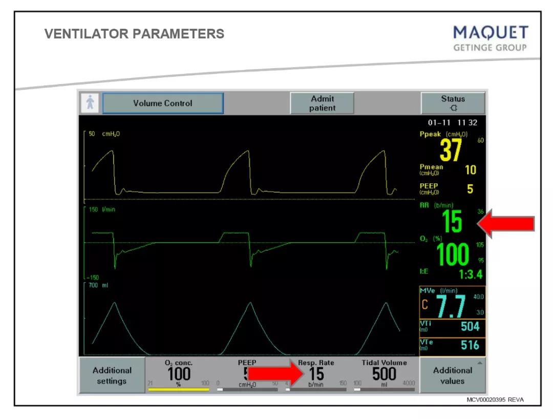 呼吸机基础知识最终版,呼吸机临床设置方法