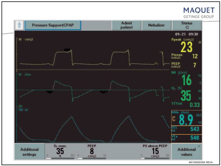 呼吸机基础知识最终版,呼吸机临床设置方法