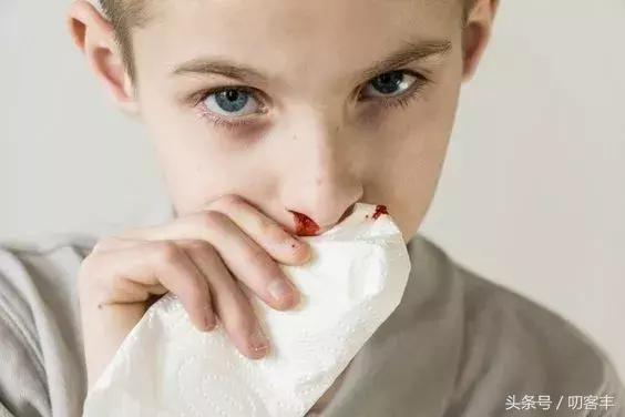 孩子流鼻血用纸堵住后不通气,孩子流鼻血被血堵住了怎么办