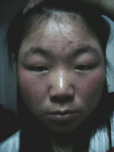 解决皮肤暗黄四点轻松搞定,皮肤暗黄肤色不均的福音