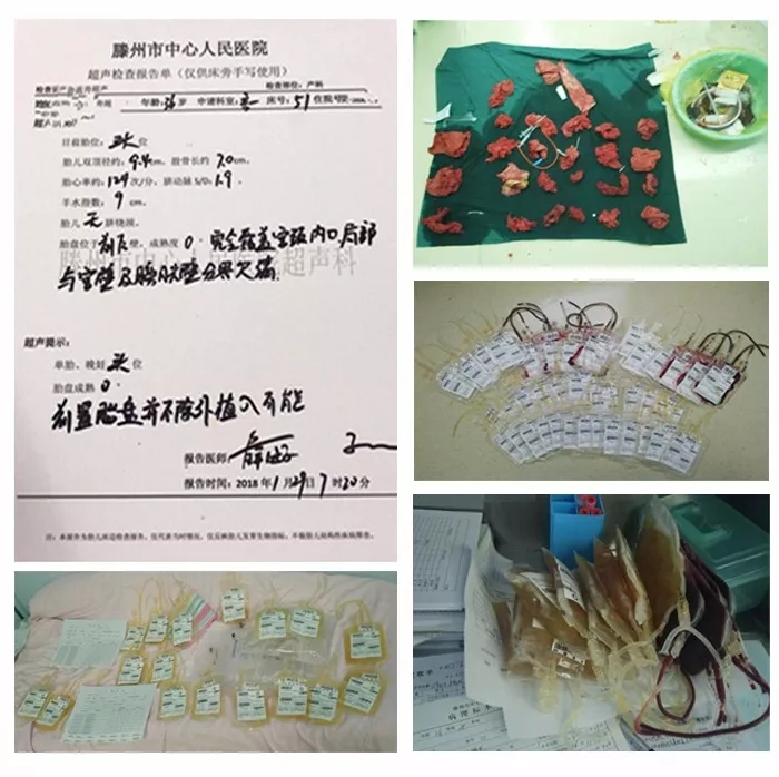 22岁产妇两次大出血病危,26岁产妇大出血身亡