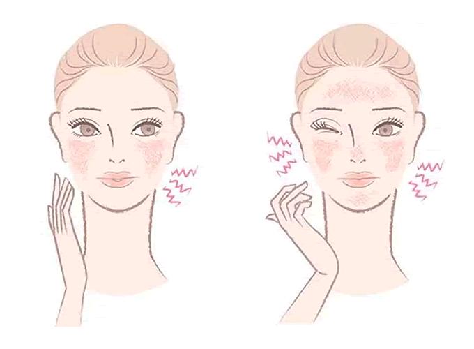 cerave敏感肌可以用吗,cerave适乐肤适合敏感肌吗