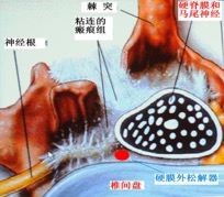 宣武医院头痛专家排名,宣武医院治疗头痛