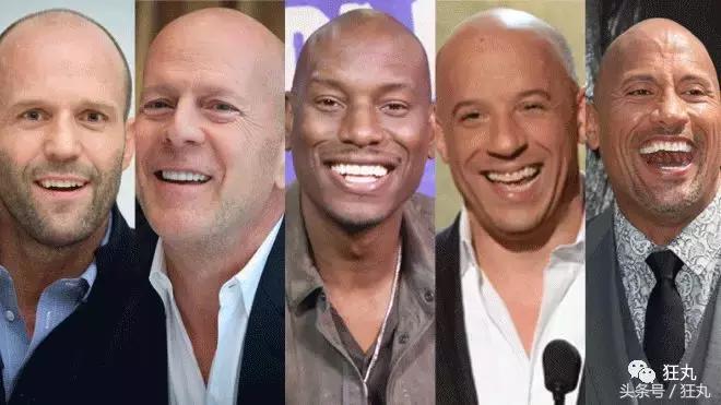 麦当劳薯条治疗脱发,麦当劳薯条掉头发