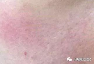 我又过敏了！拉黑！吐槽！说说那些年我跟风买过的糟心货！