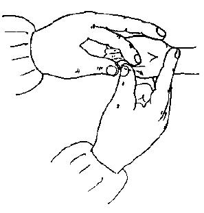 宝宝面色萎黄是什么原因,宝宝消瘦面黄是什么原因