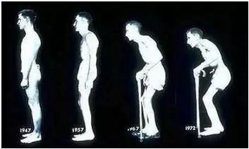 蔡少芬病好了吗,健康不得癌症的七个秘诀