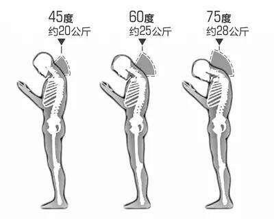 低头看手机脖子难受怎么办,低头看手机颈部不适怎么办