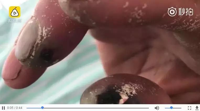 看着都疼！环卫工的手被强酸腐蚀，今天我们一起为他们倡议