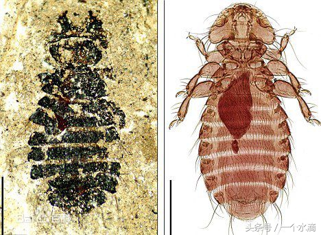你对虱子和虮子只停留在上世纪六七十年代吗?国外现在还有
