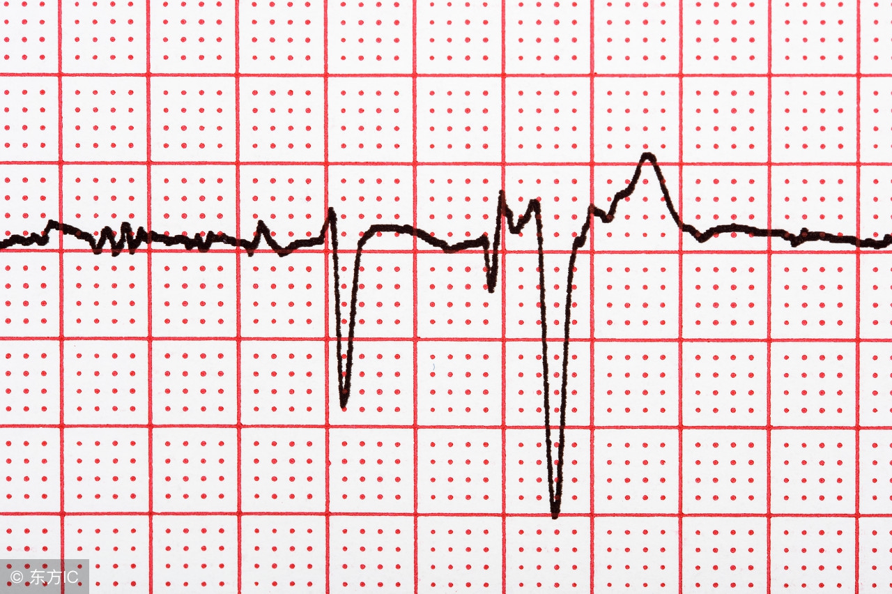 心电图偶发性房颤,什么是一过性房颤