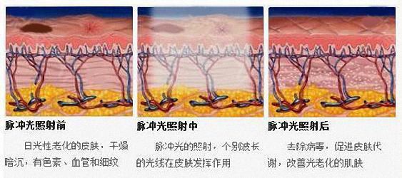 丰唇成香肠嘴视频,丰唇后像鸟嘴