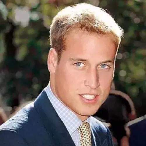 脂溢性脱发阶段,每个人都会有一段严重脱发期吗