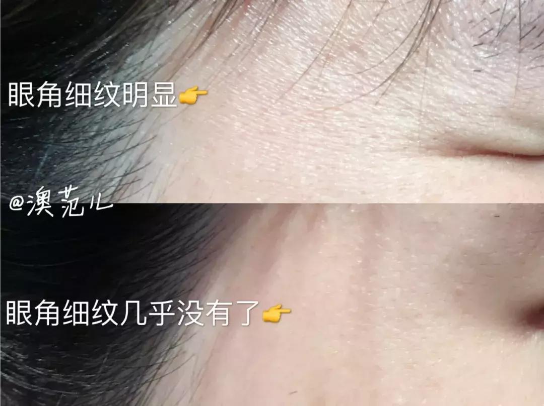 澳洲抗皱精华,50-60岁抗衰老紧致提拉精华推荐