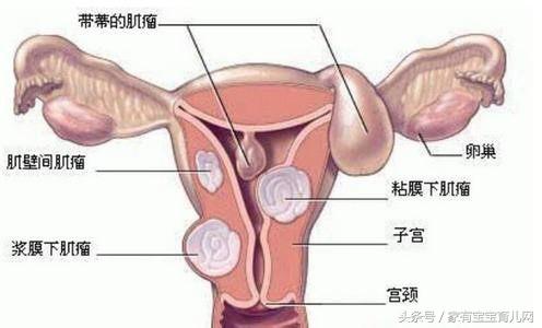 生孩子痛经好了,怀孕前不痛经生完孩子痛经很严重