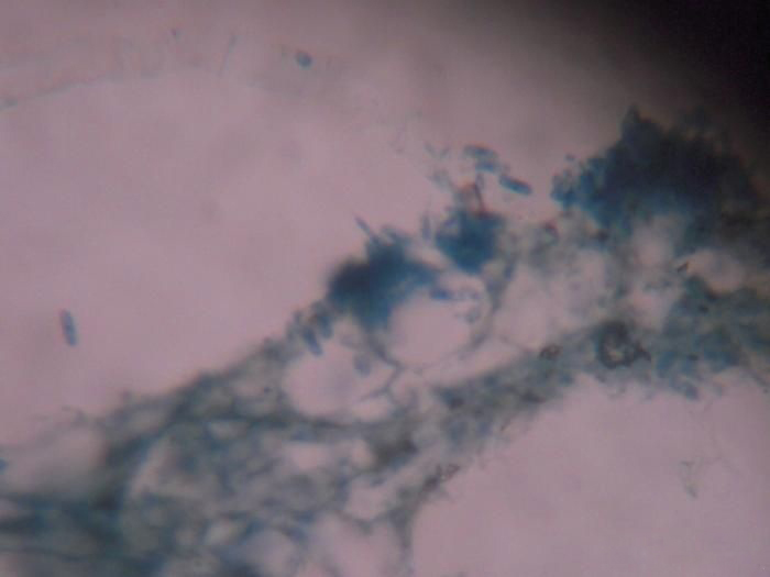 辣椒炭疽病的病原形态,辣椒炭疽病的病症为点状物