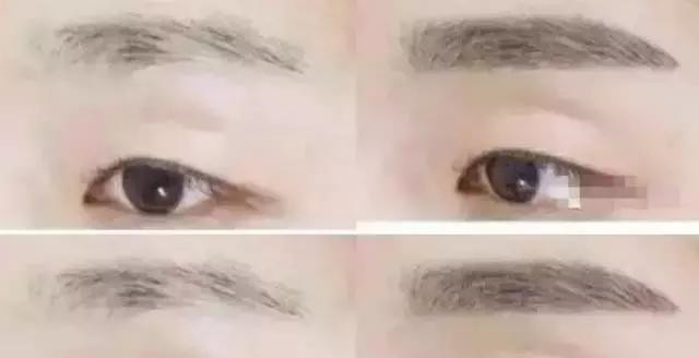 怎么让眉毛快速结痂掉痂,眉毛结痂掉痂修复过程