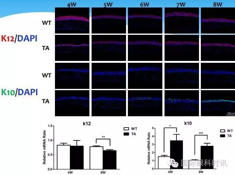 角膜会2016李炜教授:EDA基因突变鼠:一种新的睑板腺功能障碍相关性干眼动物模型